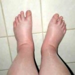 hamile-ayak-bakimi-3