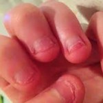 tirnak-yeme-rahatsizligi-foto00