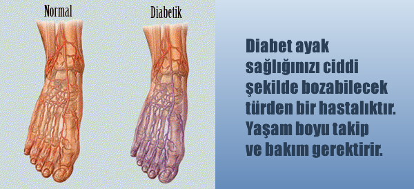 diabetik-ayak-bakimi-hakkinda