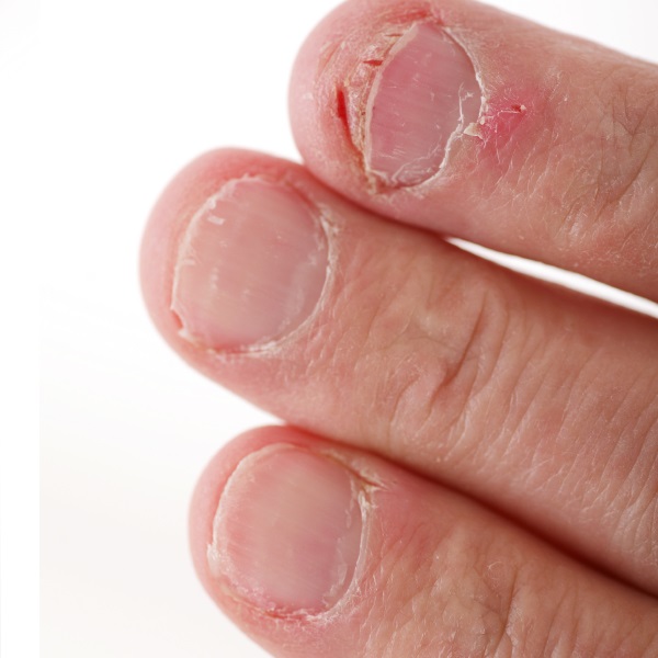 Probelle Anti-Bite, Nail Biting Treatment for Kids & Adults to Quit habit,  No Bite Nail Polish Deterrent, Thumb Guard & Prevents Finger Sucking,  Bitter Taste Nail Care, For Ages 3+, 0.5 fl