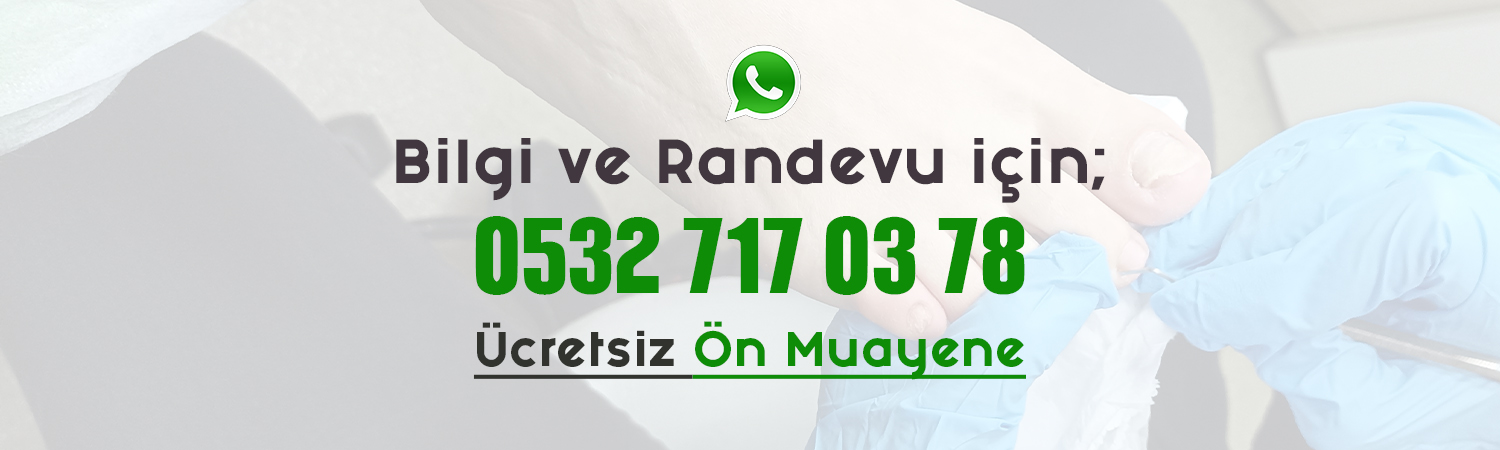 image-bilgiverandevubanner_yeni_TR